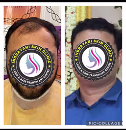 inrayani-skin-clinic-results